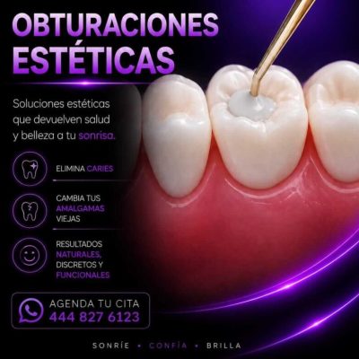 Obsturaciones estéticas (1)